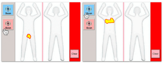 Image: âAnomaliesâ highlighted in millimeter wave scanner interface, by Dr. Cary Gabriel Costello